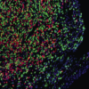 intracellular infections