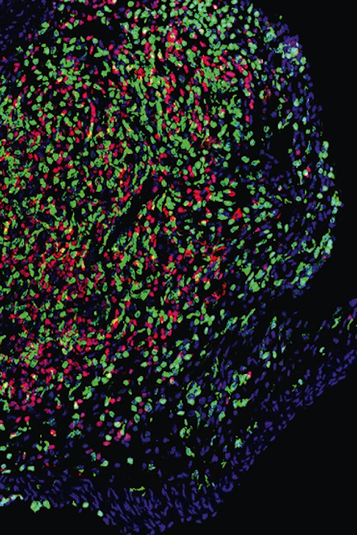 intracellulaire infecties