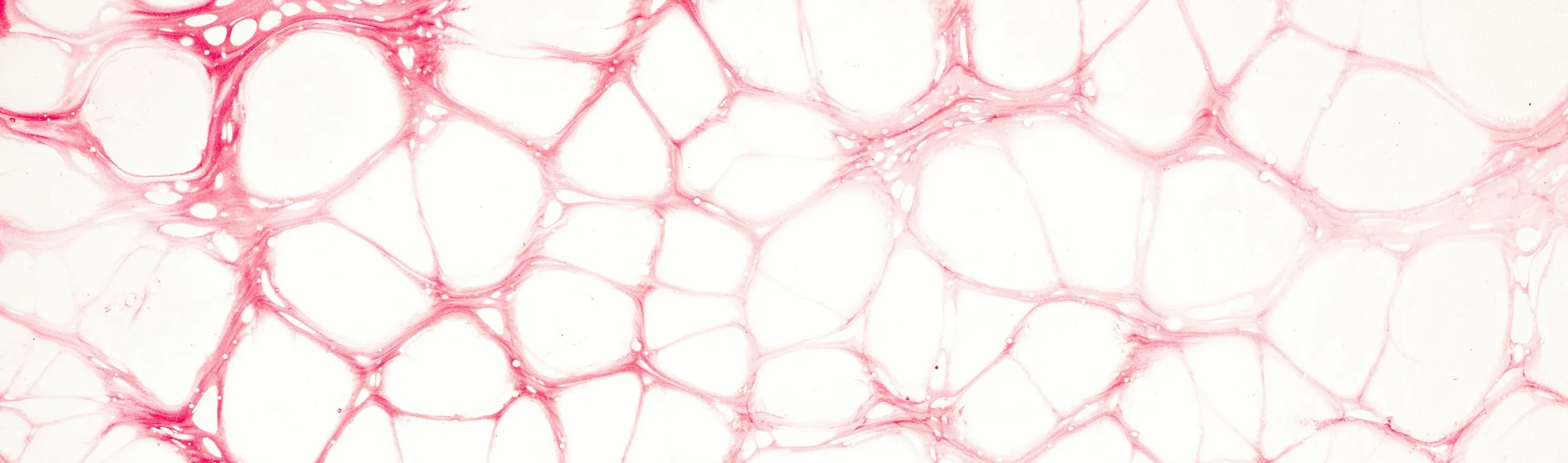 Extracellulaire matrix