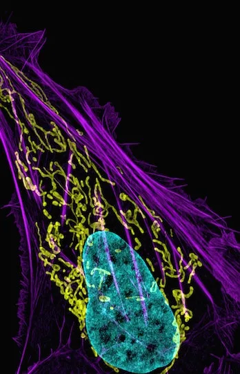cancer tissue