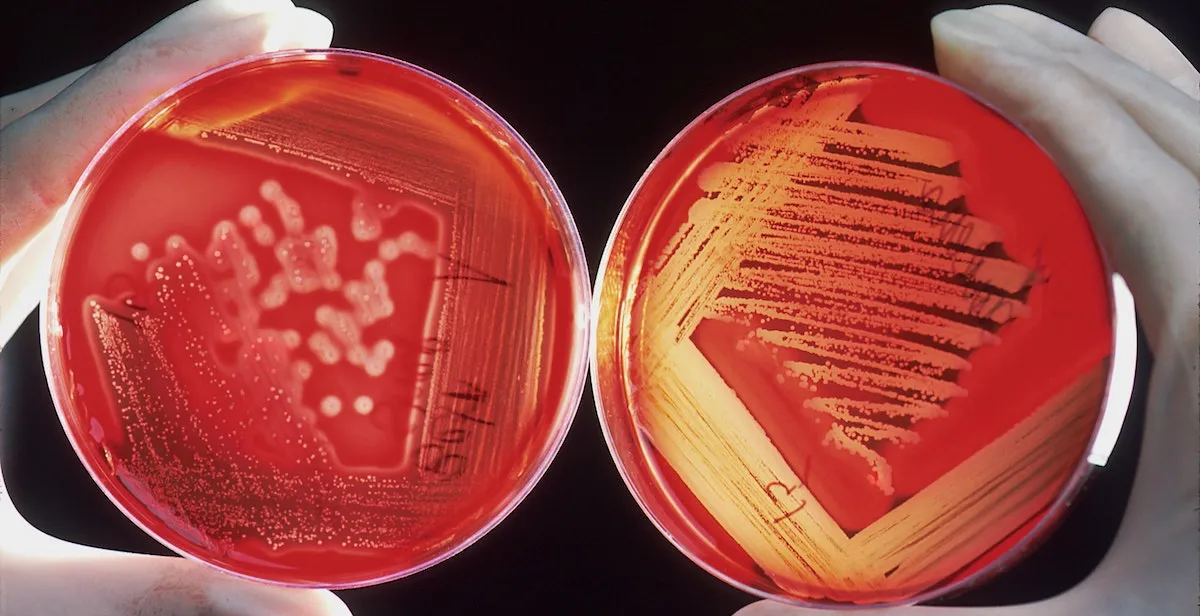 infections