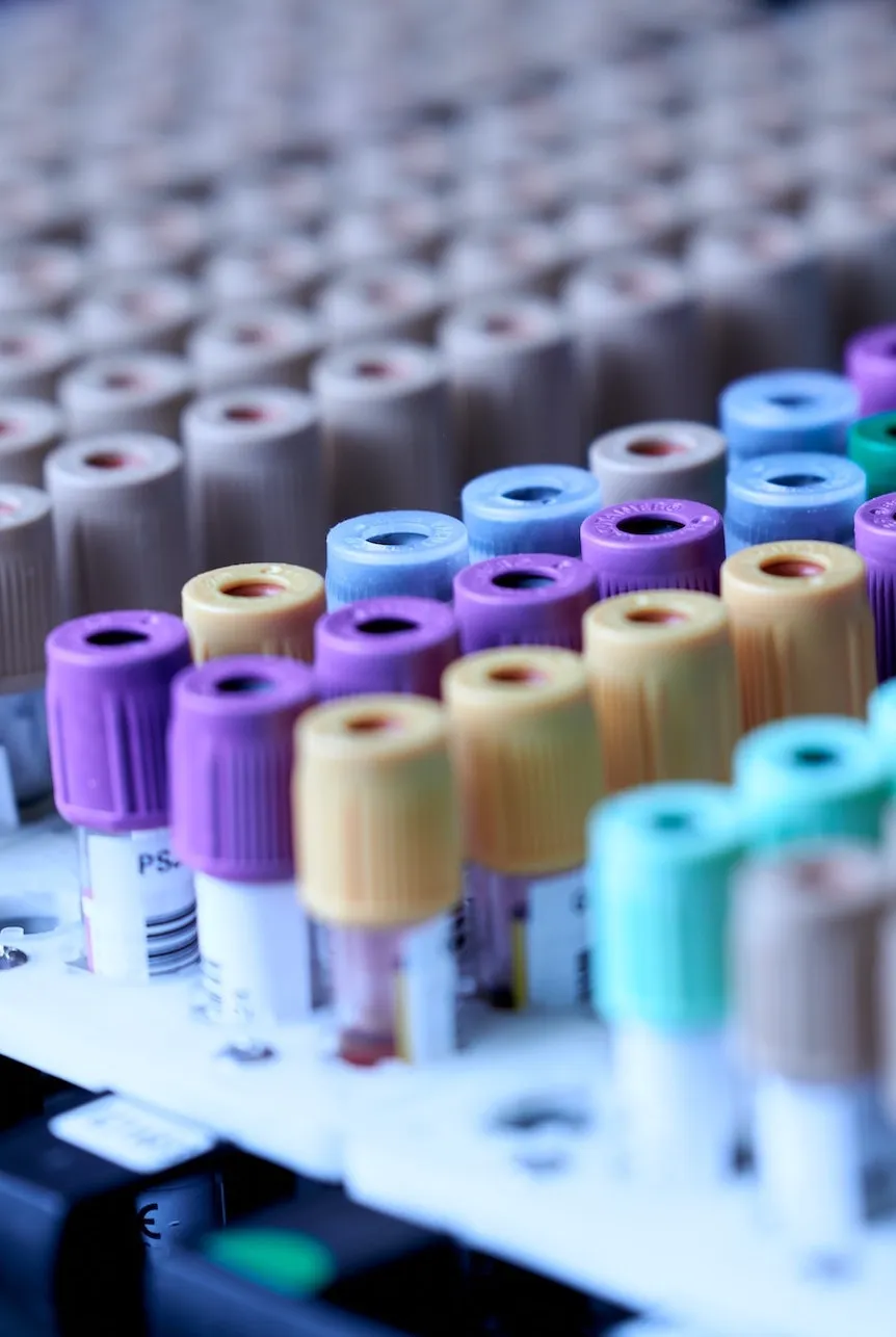laboratory tubes